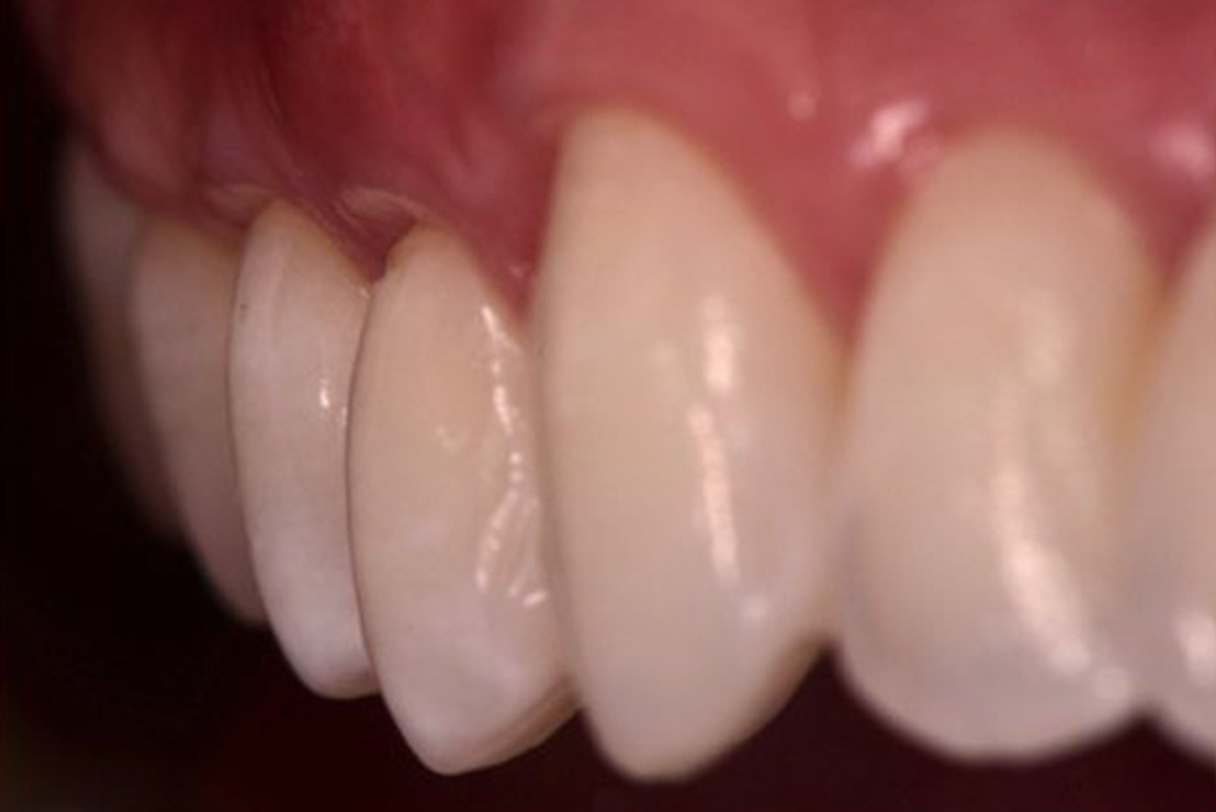close up denti chirurgia