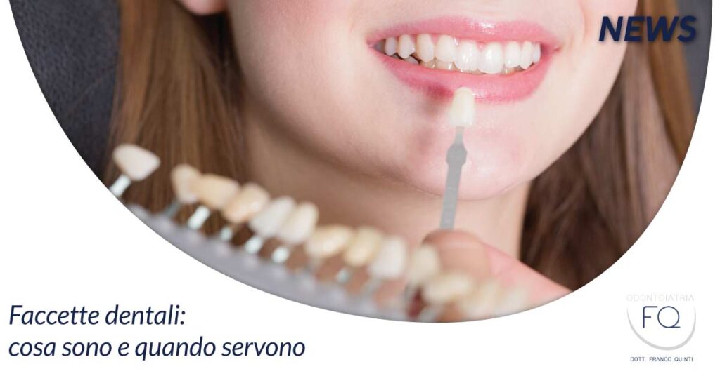 faccette dentali | Odontoiatria Fq | Dentista Monte San Savino Arezzo